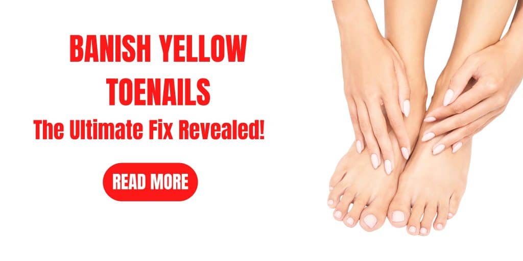 yellow toenails