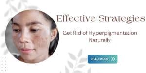 Read more about the article How to Get Rid of Hyperpigmentation:Ultimate Guide to Clear Skin