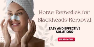 Read more about the article Blackheads Removal at Home: Your Ultimate Guide to Clear Skin
