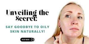 Read more about the article How to Remove Oily Face Naturally: Your Comprehensive Guide