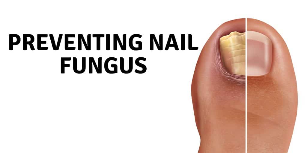 nail fungus home remedy