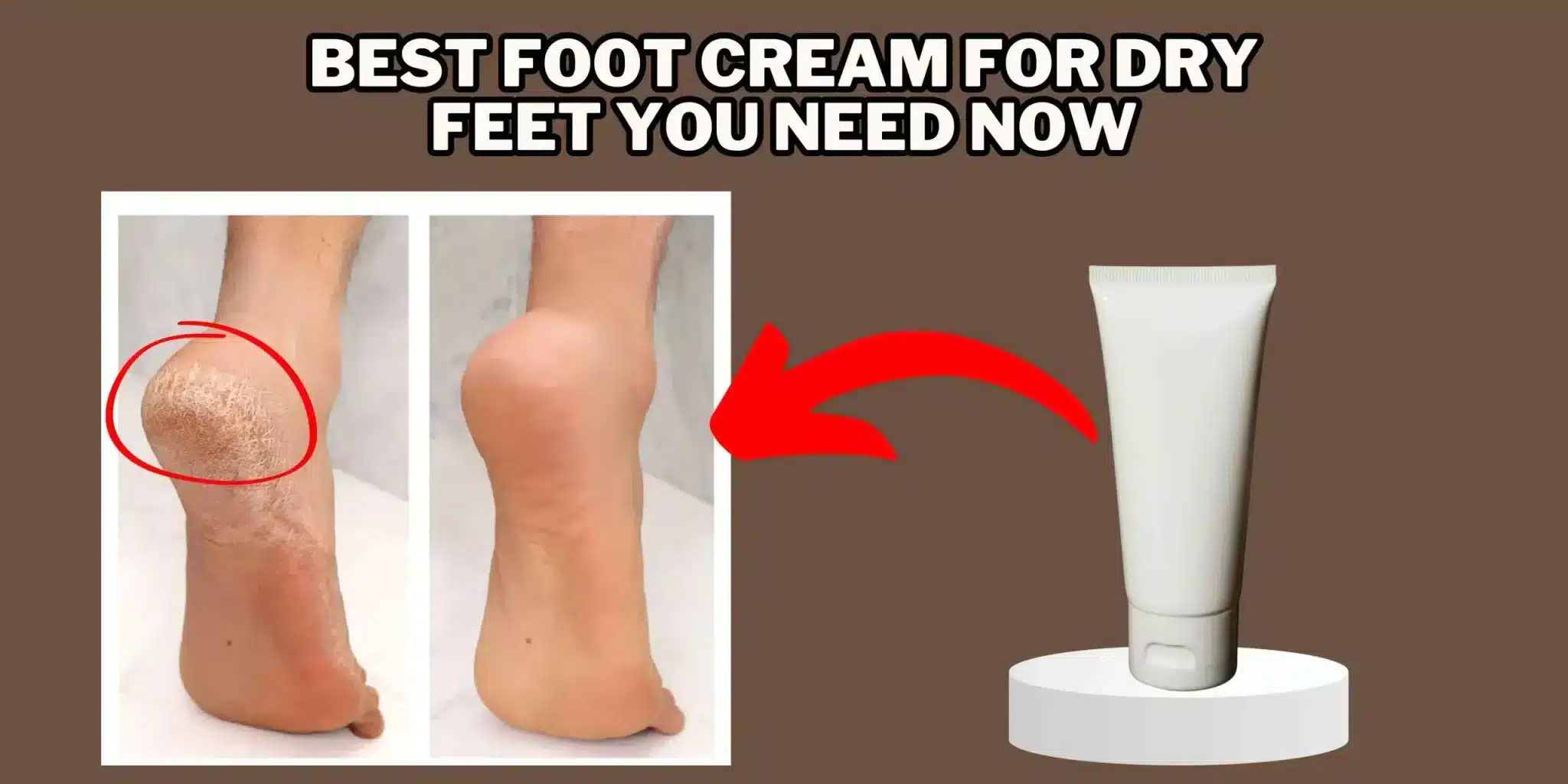 Read more about the article Best Foot Cream for Dry Feet: Unveiling the Top Picks of 2024